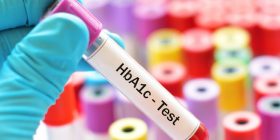 A1C and blood glucose level