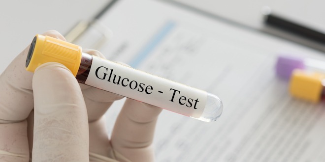 routine blood glucose